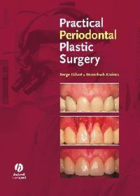 Practical Periodontal Plastic Surgery